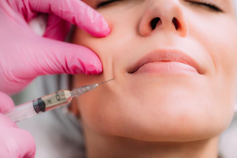 Close-up of a woman receiving dermal fillers for smile lines to smooth nasolabial folds and restore youthful skin