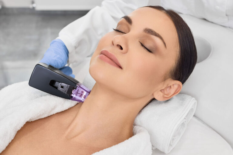 Woman receiving RF microneedling treatment at a medical spa, illustrating RF microneedling cost factors.