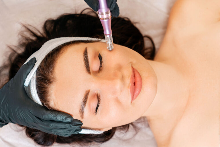Woman receiving microneedling to promote skin tightening and improve firmness.