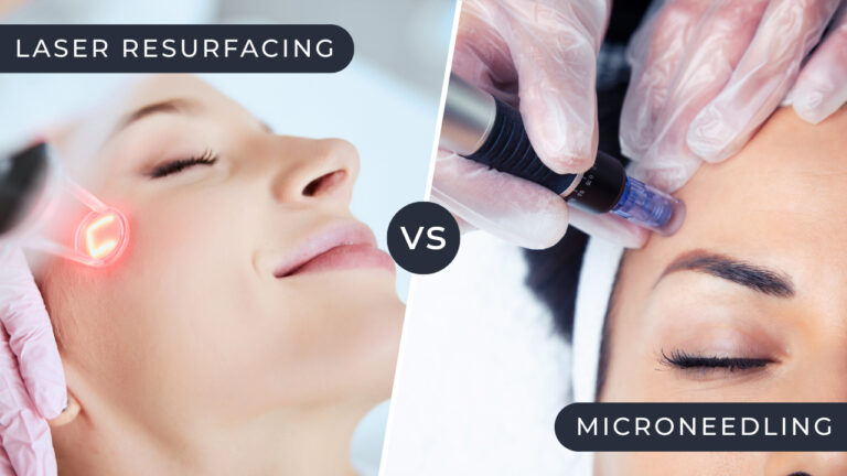 Split screen graphic showing the difference between laser skin resurfacing and microneedling procedures at a luxury med spa.