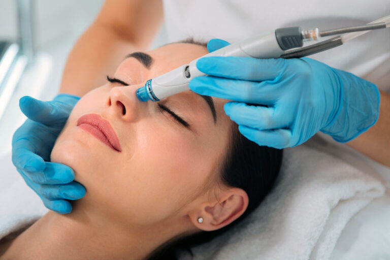Close-up of hydrafacial exfoliation treatment on woman’s nose supporting how long hydrafacial results last.