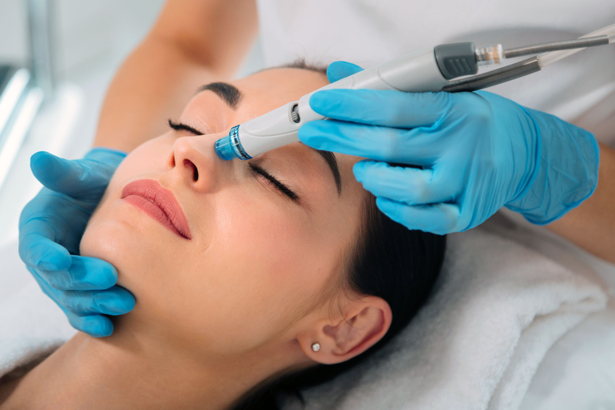 Close-up of hydrafacial exfoliation treatment on woman’s nose supporting how long hydrafacial results last.