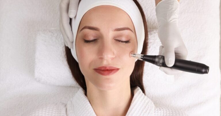 Close-up of a microneedling device being applied to a woman's face during a professional skin treatment session