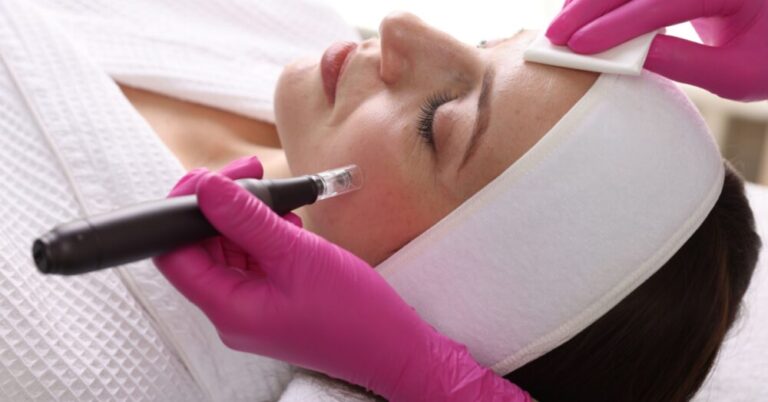 Provider performing a microneedling treatment on a woman's face in a clinical setting