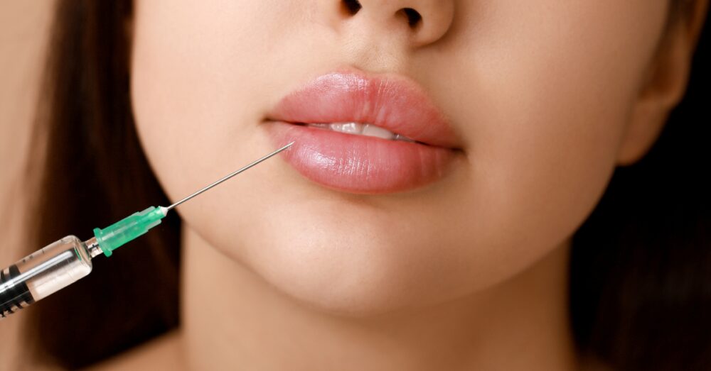 Close-up of a woman's lower face receiving a lip filler injection
