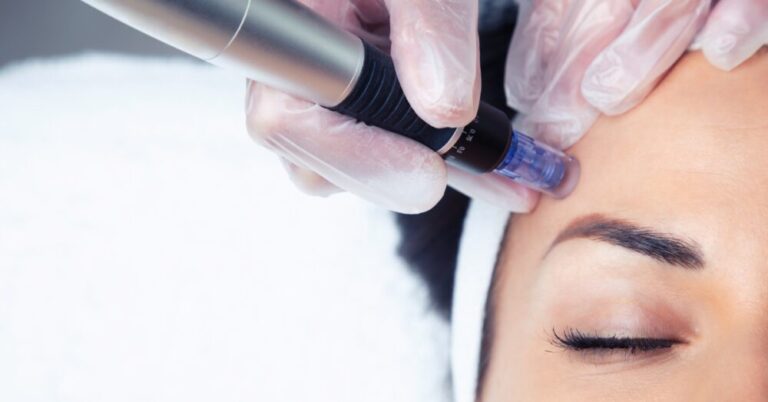 A close-up of a microneedling device being applied to the forehead area of a woman with closed eyes during a skincare treatment session