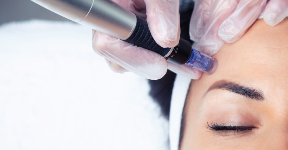 A close-up of a microneedling device being applied to the forehead area of a woman with closed eyes during a skincare treatment session